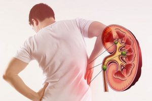 Quan Hệ Tình Dục Nhiều Có Làm Yếu Thận Không?